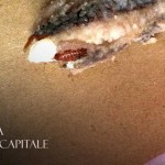 ChiusoLocalexScarsaIgiene